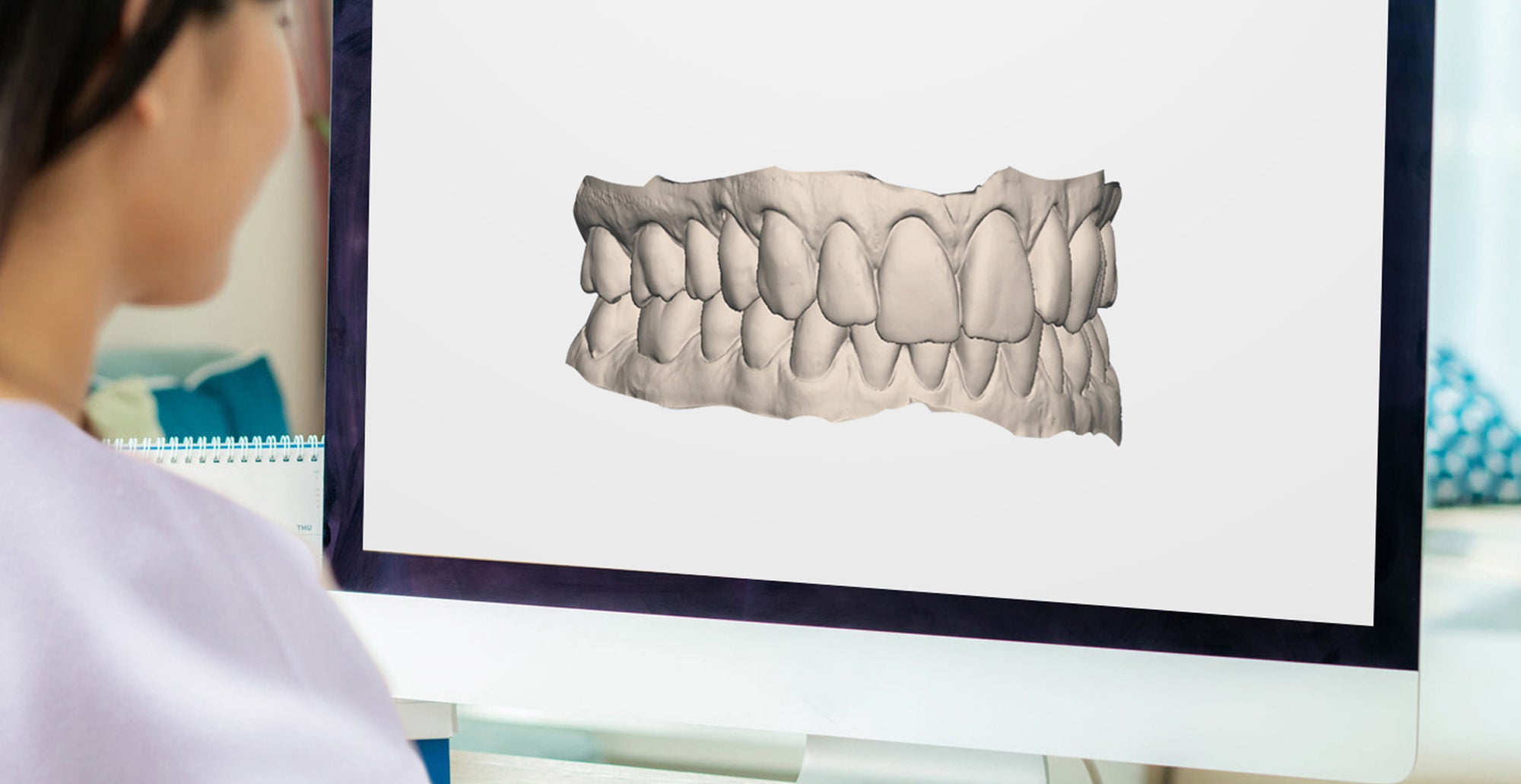 Before After 3D Treatment Preview By Licensed Dentists & Orthodontists - NewSmile